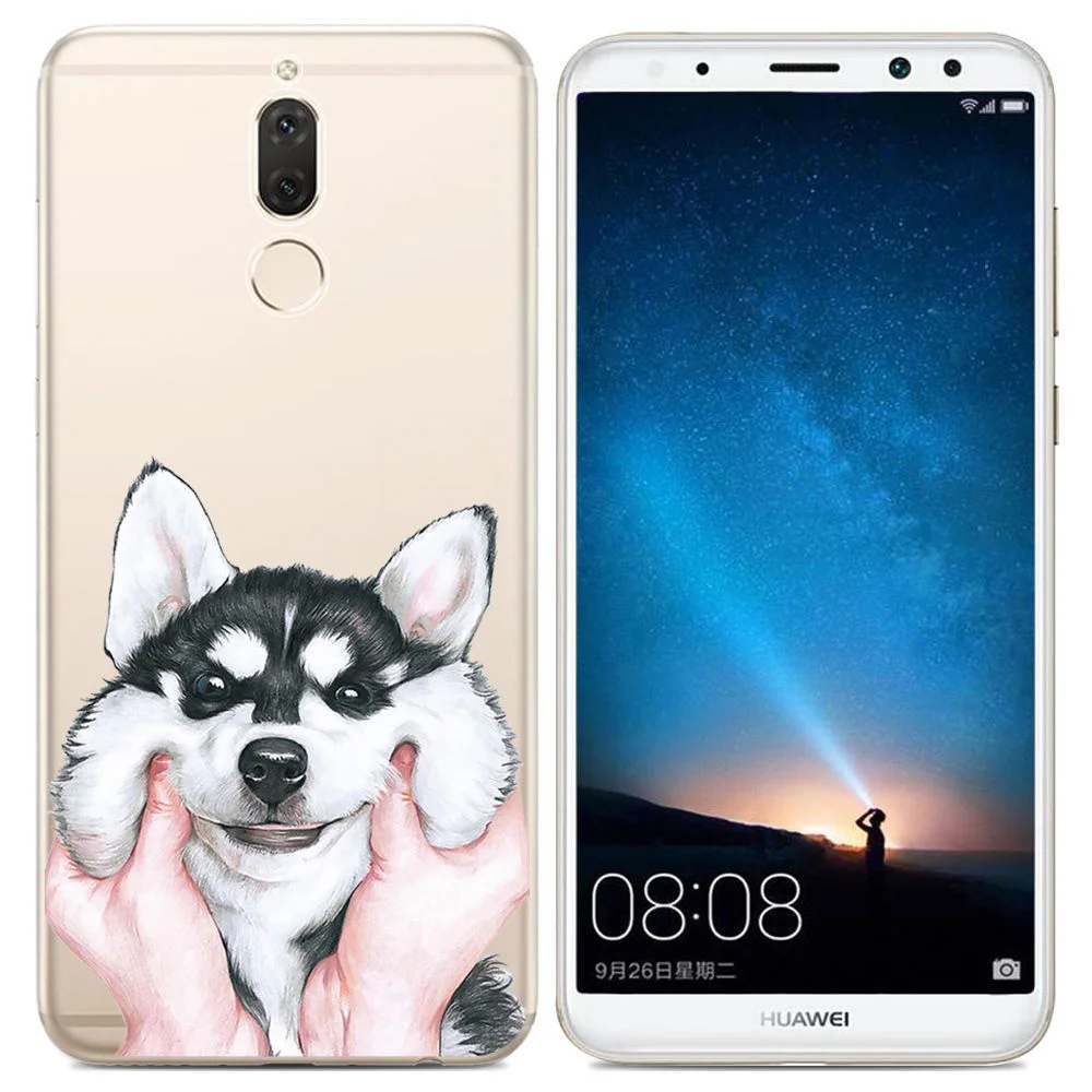 N-KHW1928I_1_JONSNOW Case for Huawei Mate 10 Lite 5.9 inch Printing Soft TPU Phone Back Protective Cover for Huawei Mate 10 Lite