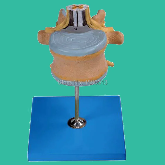 

Lumbar Vertebra with Spinal Cord and Cauda Equina Nerve Model