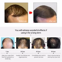 20 мл жидкость для роста волос твердая защита волос натуральный травяной экстракт средства для роста волос лечение волос