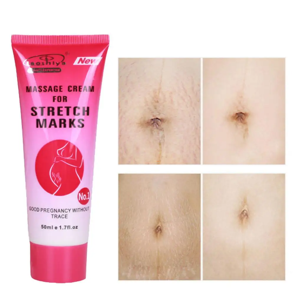 

50g Firming Abdomen Reducing Stretch Mark Cream Remove Scars Relieve Acne Body Scars Skin Care Repair Acne Scar Massage Cream