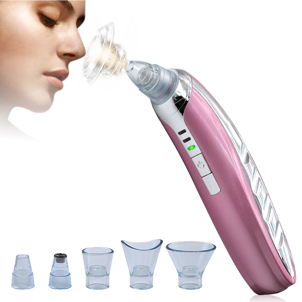 Vacuum extraction Vacuum extraction