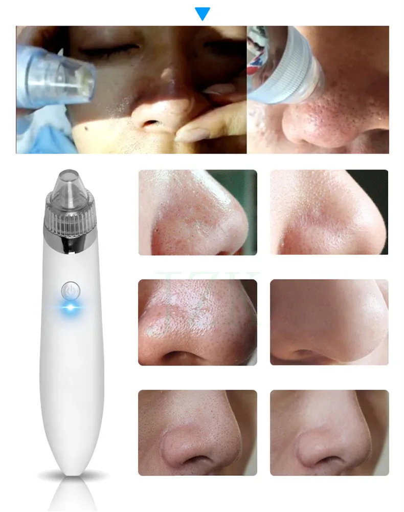 Blackhead Remover Face Deep Pore Cleaner Acne Pimple Removal Vacuum Suction Facial Dark Spot Remover Beauty Suction Skin Care