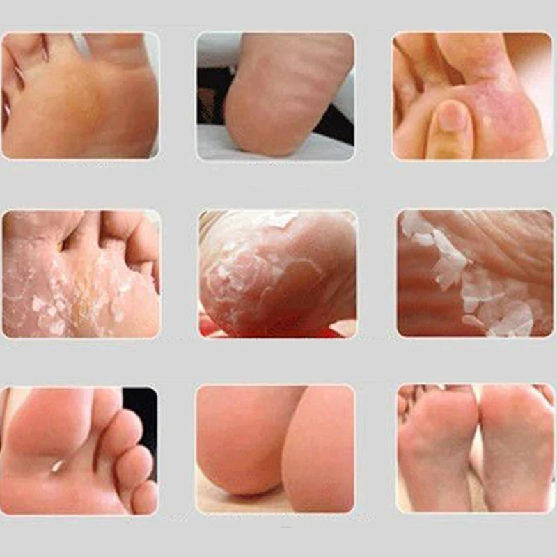 baby foot uk