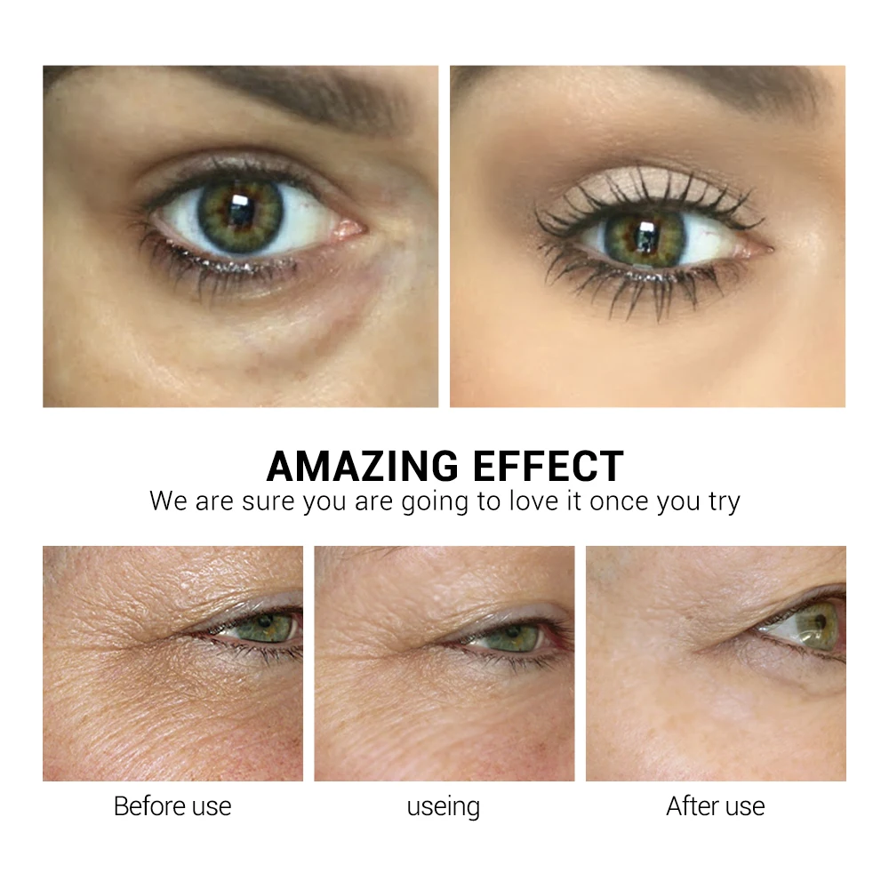 upper eyelid firming cream