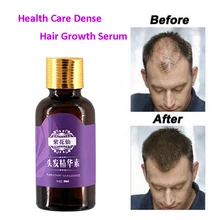 20ml Schnelle Haar Wachstum Schneller Wachsen Nachwachsen Der Haare Für Männer Frauen Reine Natürliche Haarausfall Produkte Pilatory Behandlung Anti-haar Verlust