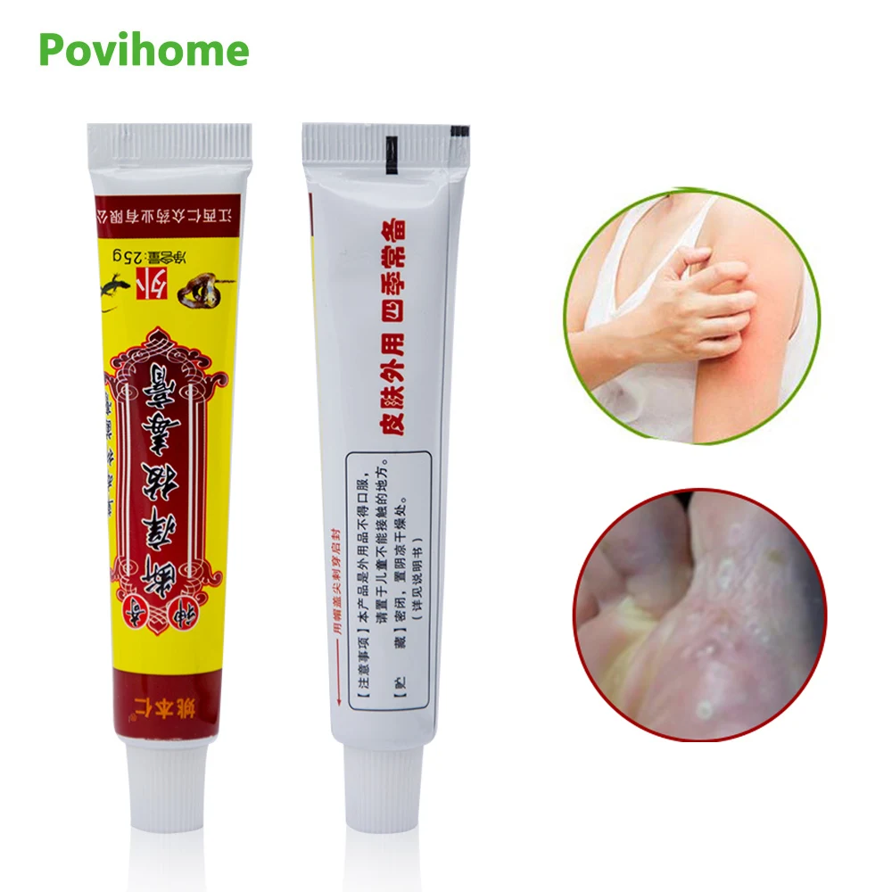 

1pcs Antibacterial Cream Anti-itch Psoriasis Ointment Feet Rotten Peeling Blisters Foot Corn Medical Plaster Skin Care P1014
