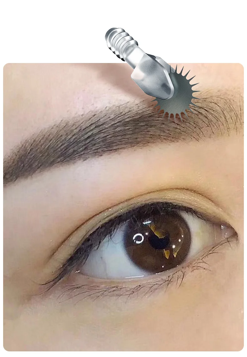 99