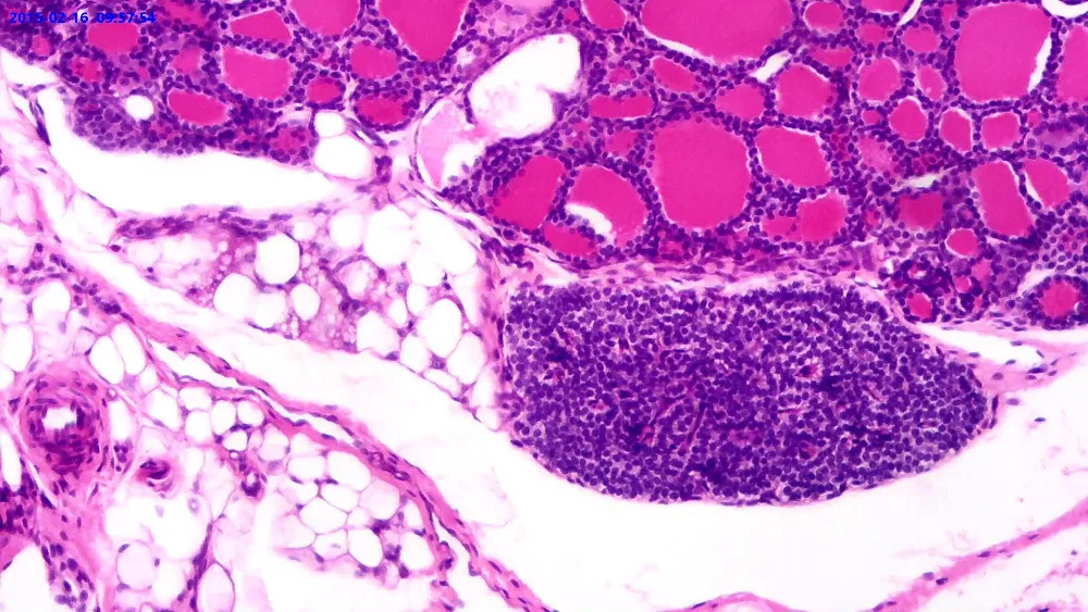 86_Simple_Cuboidal_Epithelium_Sec
