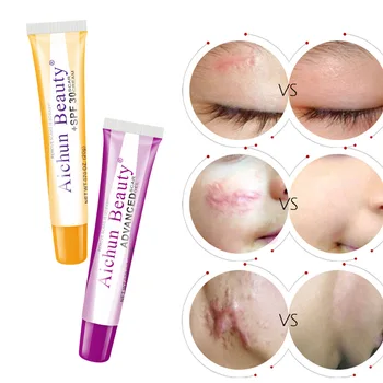 melhor 20g Escalde Tratamento De Manchas De Acne Cicatriz Cirúrgica Tratamento De Estrias Reparação Creme Creme De Clareamento Reparação Da Pele Creme Para O Rosto SPF30