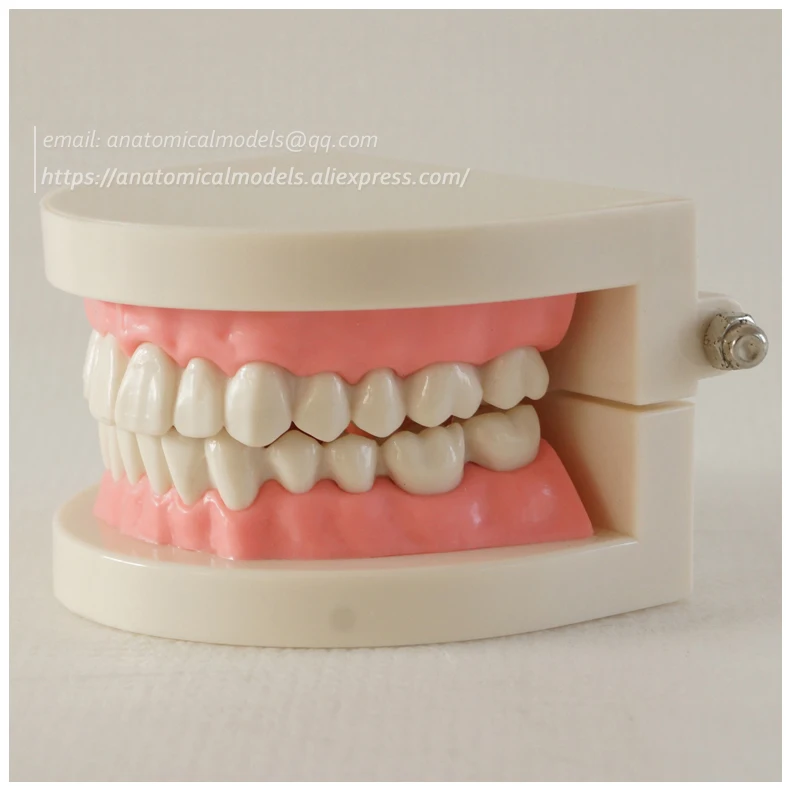 CMAM-DH209 Orthodontics dental chinamedicalanatomicalmodels 2 