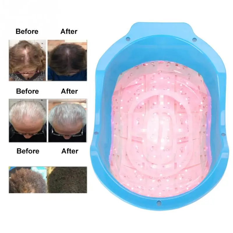 

Updated Laser Hair Regrowth Helmet Hair Treatment Therapy Helmet Oil Control Anti Hair Loss Cap Promote Hair Regrowth Cap