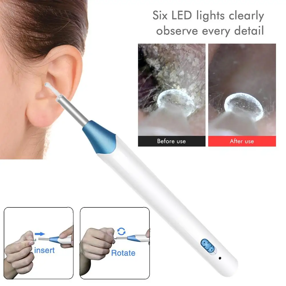 

2019 Newest Wifi Ear Cleaner Wireless Ear Otoscope Inspection Camera With 6 LED For Ear Wax Removal For IPhone Android