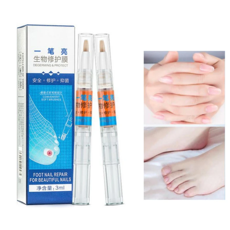 Fungal Nail Treatment Pen Essence Nail Foot Whitening Toe Nail Fungus Removal Feet Care
