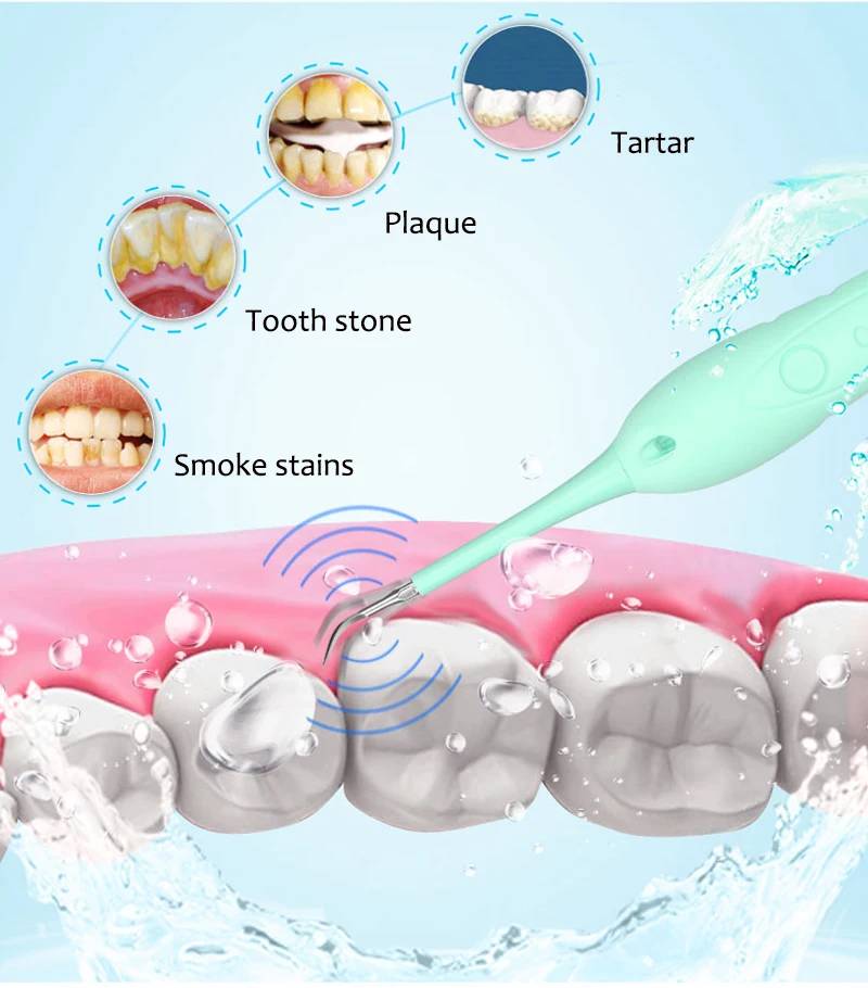 Отбеливание зубов Домашнее использование удаление зубных пятен зубной камень зубы пятна Масштабирование usb зарядка высокая частота вибрации стоматологические инструменты