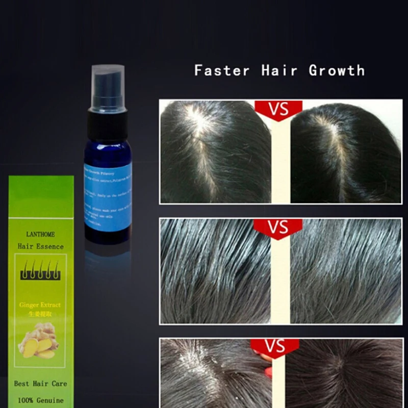 30ML Hair Growth Essence Fast Hair Growth Products Dense Hair Regrowth Essence Hair Loss Treatment