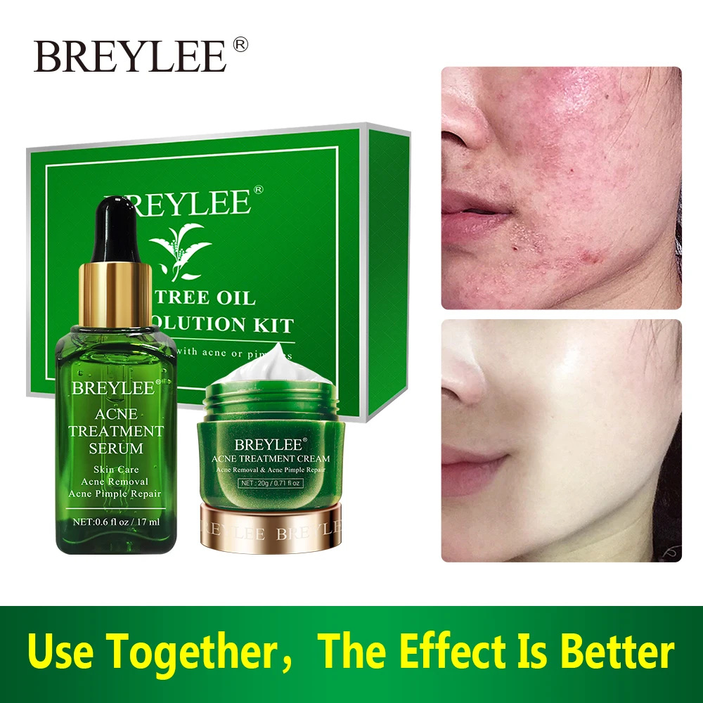 

BREYLEE Acne Solution Kit Acne Treatment Serum Cream Spots Pimple Removal Essence Anti Acne Scar Skin Care Face Cream