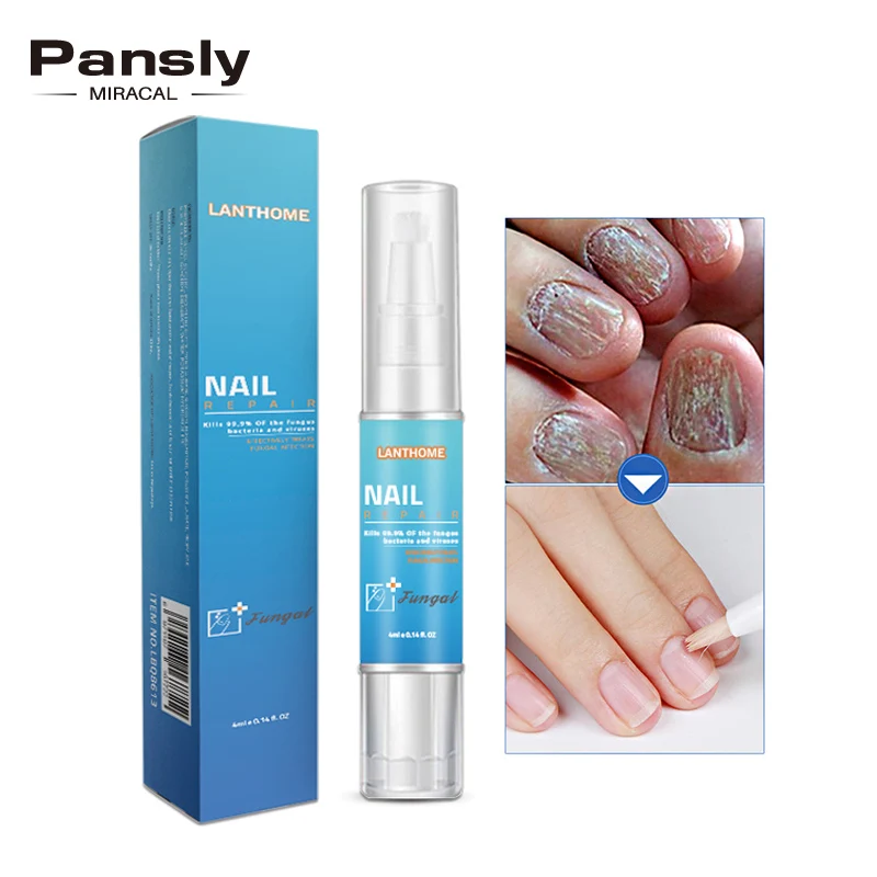 

Cuticle Remover Herbs Fungal Nail Treatment Toe Nail Fungus Removal Gel Feet Care Essence Foot Whitening Bright Anti Infection