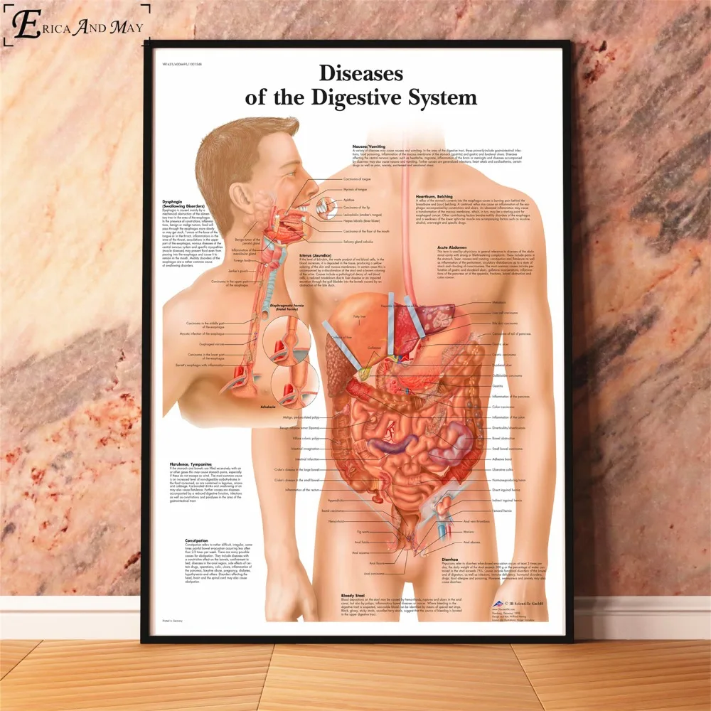 Анатомия болезни патологии диаграмма картина, печатный плакат декоративные настенные картины для комнаты без рамки украшения дома аксессуары