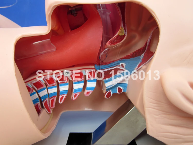 J50 K 50 intubation 4