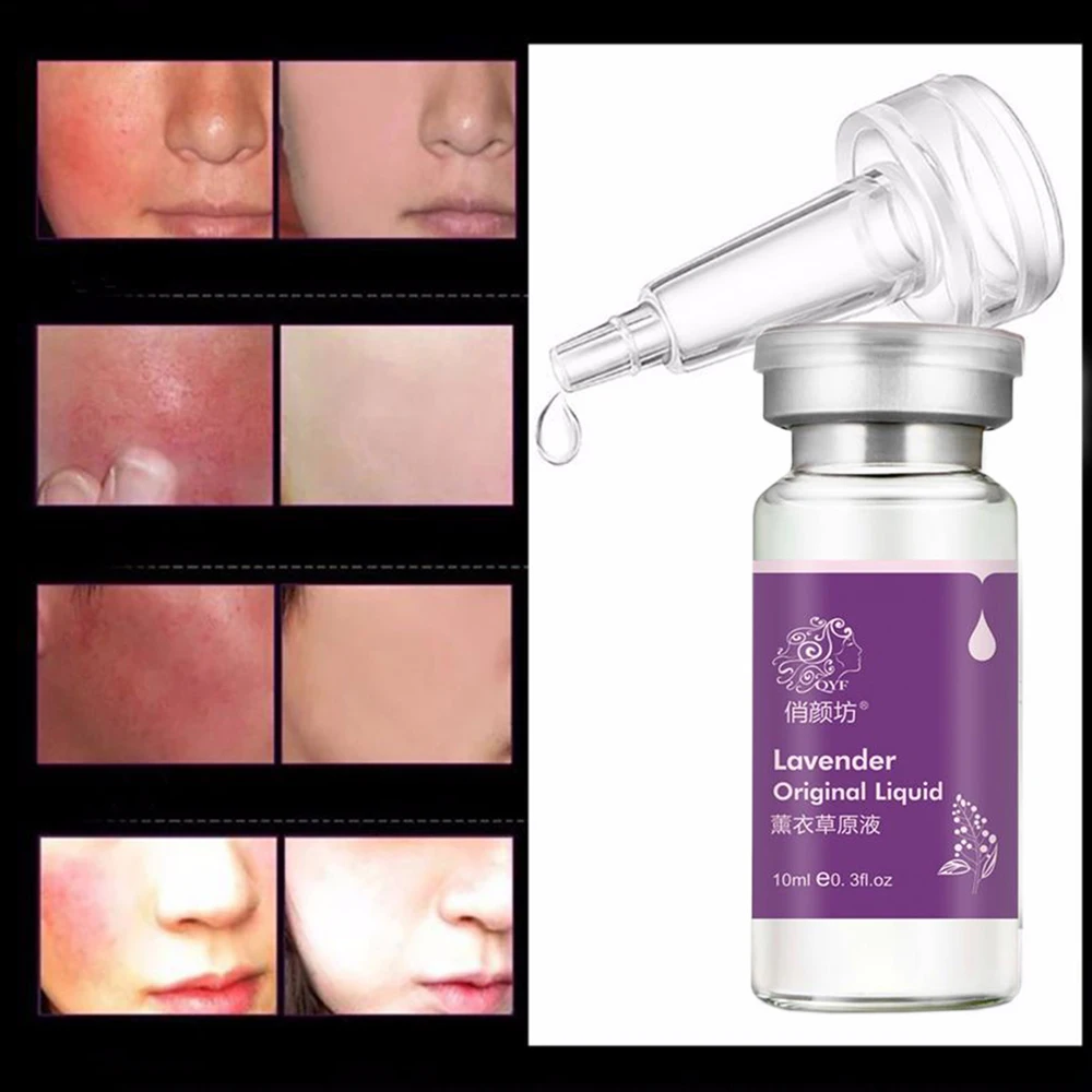 

QYF Brand Skin Care Lavender Essence Serum Face Lift Anti-Allergy Remove Acne Scar Regulate Sebum Ageless Anti-wrinkle Cream 70