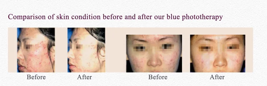 Personal Care Tools treatment face massage tool ultrasonic galvanic ion photon face massager skin face massage products 3d face massager