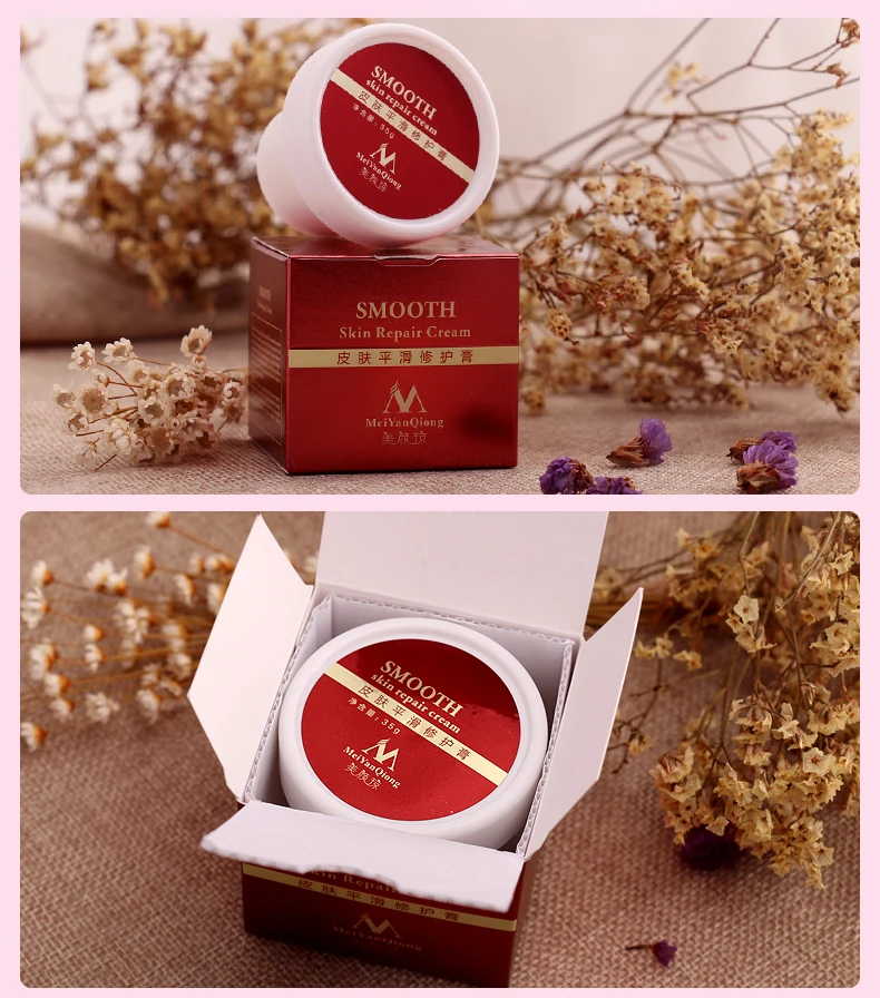 Creme de Pele para Estrias Remoção da Cicatriz para Reparação da Pele Dropshipping Suave Maternidade Creme Corporal Remover Cicatriz Pós-parto 10 Pçs 11 Cheap Maternidade