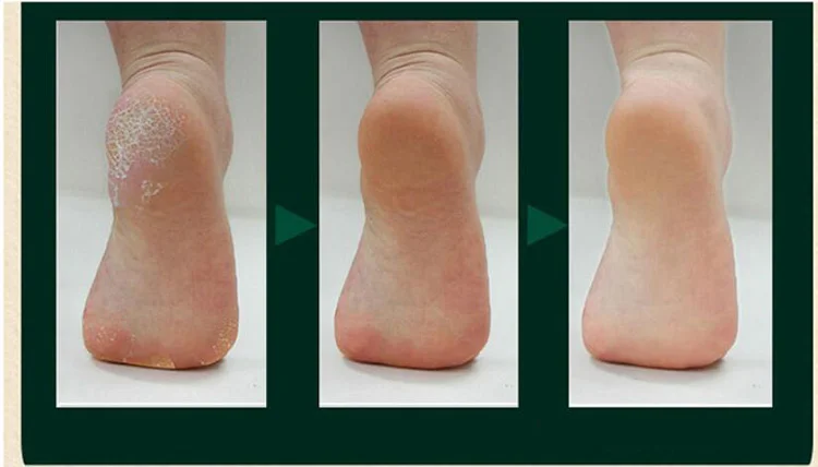 2 пары силиконовых пяток Защита ног для обуви колодки для мужчин и женщин носки Силиконовый протектор сухой трещины увлажняющий гель