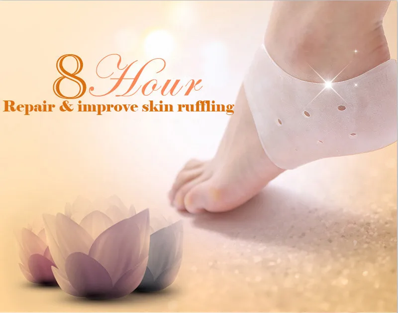 Cracked-heel-foot-careSEBS-004