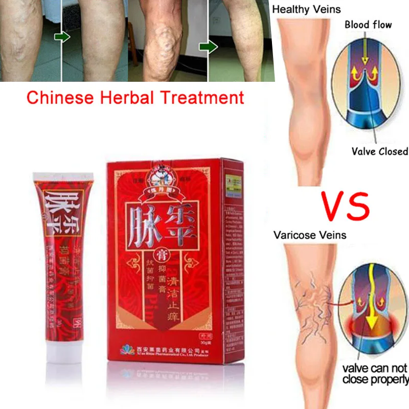 

Best Selling Varicose Veins Cream Relief Phlebitis Angiitis Inflammation Blood Vessel Health Care 998