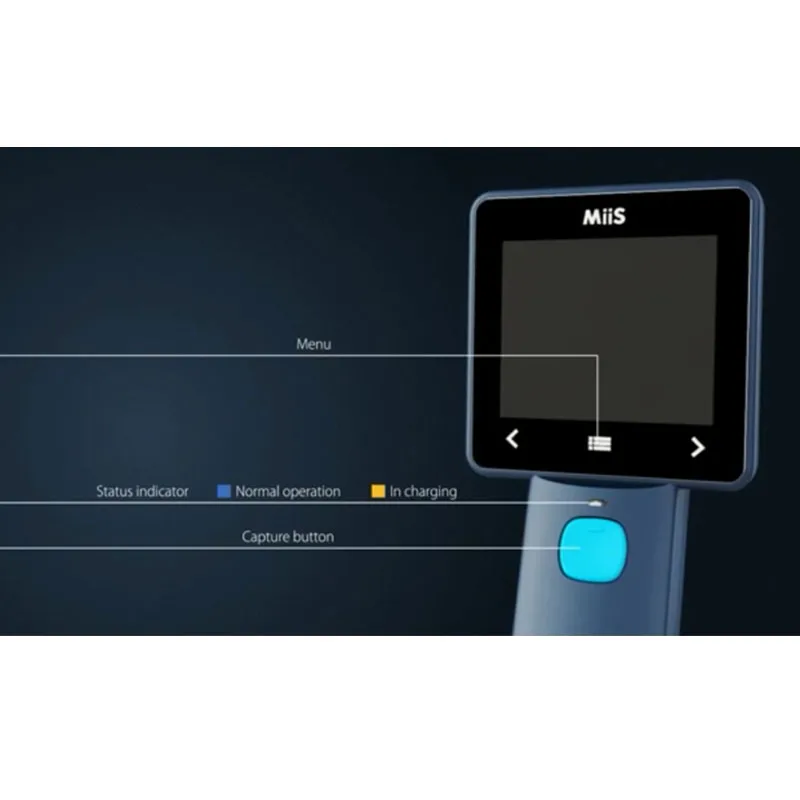 Цифровой отоскоп диагностики Miis Horus EOC 100|otoscope|otoscope digitalotoscope video |