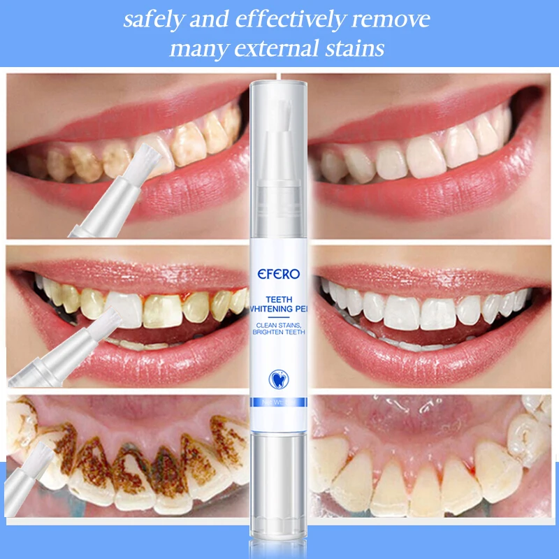 EFERO, отбеливающая ручка для зубов, зубная щетка, эссенция, гигиена полости рта, чистящая сыворотка, Удаляет налет, пятна, отбеливание зубов, стоматологические инструменты