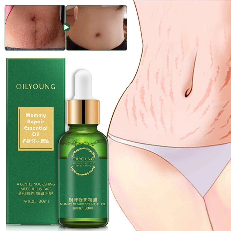 

Newest tretch Mark Repair Oil Nourishing Skin Quickly Remove Stretch Marks Mommy Repair Essential Oil