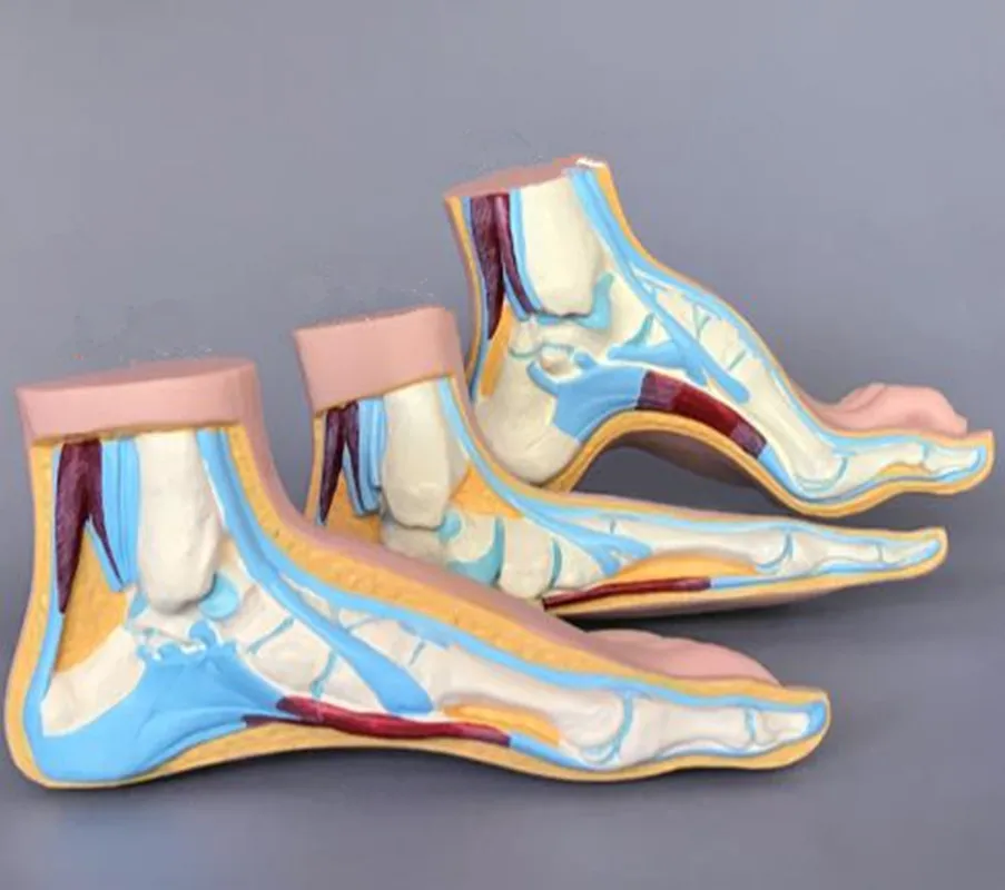

Normal flat and arched foot model teaching and medical models 3pcs