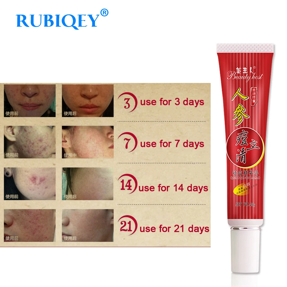 

Ginseng Rapid Cure Acne Treatment Cream Scars and Stretch Marks Remover Acne Scars Cream Anti Acne Treatment Herbal Essence