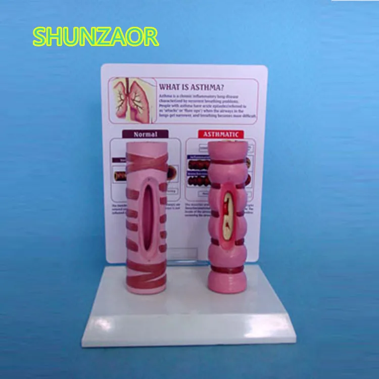 

SHUNZAOR Table trachea comparison model morbid trachea comparative anatomy model human teaching medical teaching aids