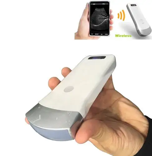 2019 Wireless ultrasound convex array probe Uprobe