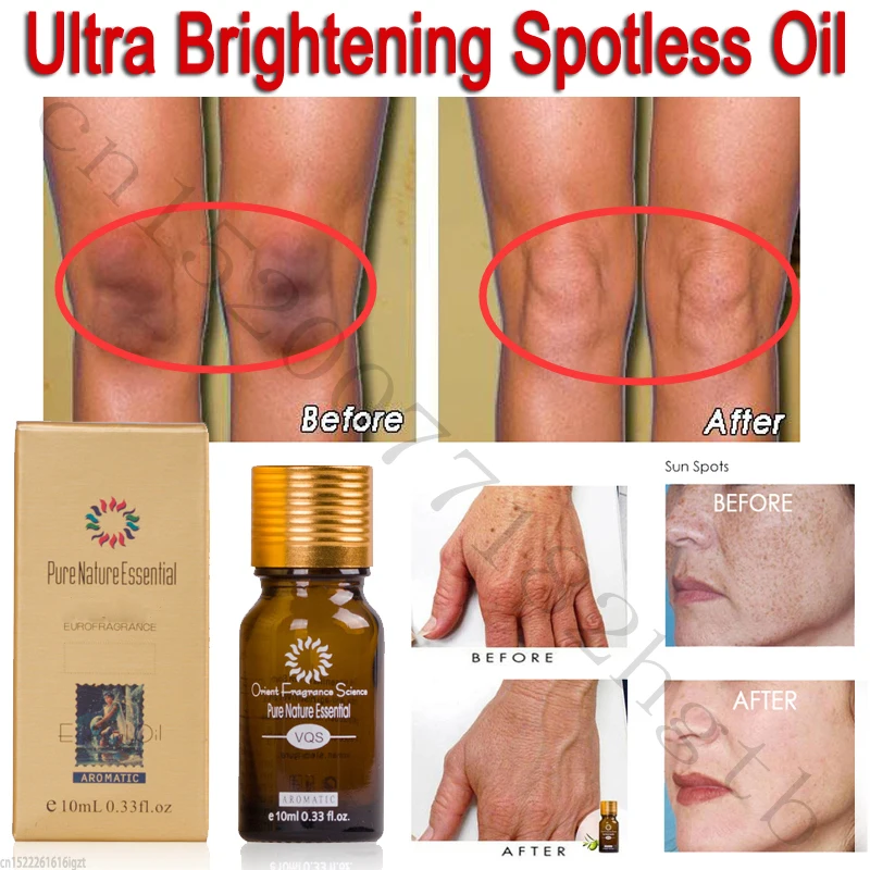 10ML Pure Nature Essential Ultra Brightening Spotless Oil Skin Care Dark Spots Remove Ance Burn Strentch Marks Scar Face&ampBody | Красота и