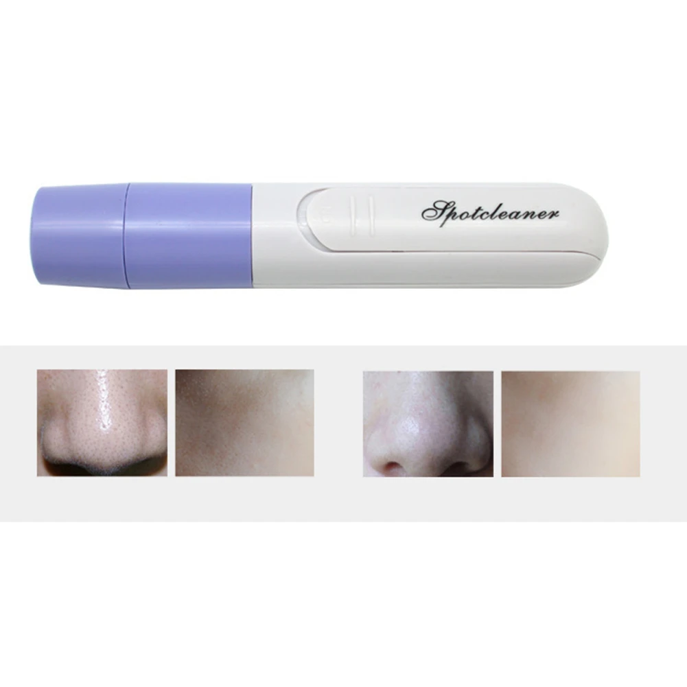 Electronic Beauty Suction Blackhead Facial Cleaning Instrument Blackhead Remover Pore Cleaner