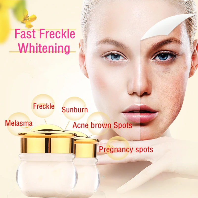 Dimollaure травяной отбеливающий крем + Сыворотка Kojic Acid для удаления мелазмы веснушки