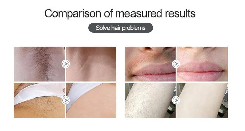 -1 
