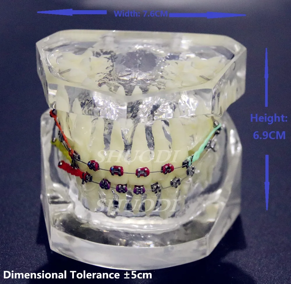 Прозрачная Стоматологическая Ортодонтическая модель мальлокклюзии с кронштейнами Archwire buccal пробки извлечения зуба для связи пациента