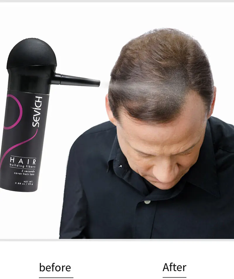 Строительный волоконный спрей-аппликатор для волос, волоконный аппликатор, Распылительная насадка, насос, спреи для волос, для выпадения волос, Sevich, бренд