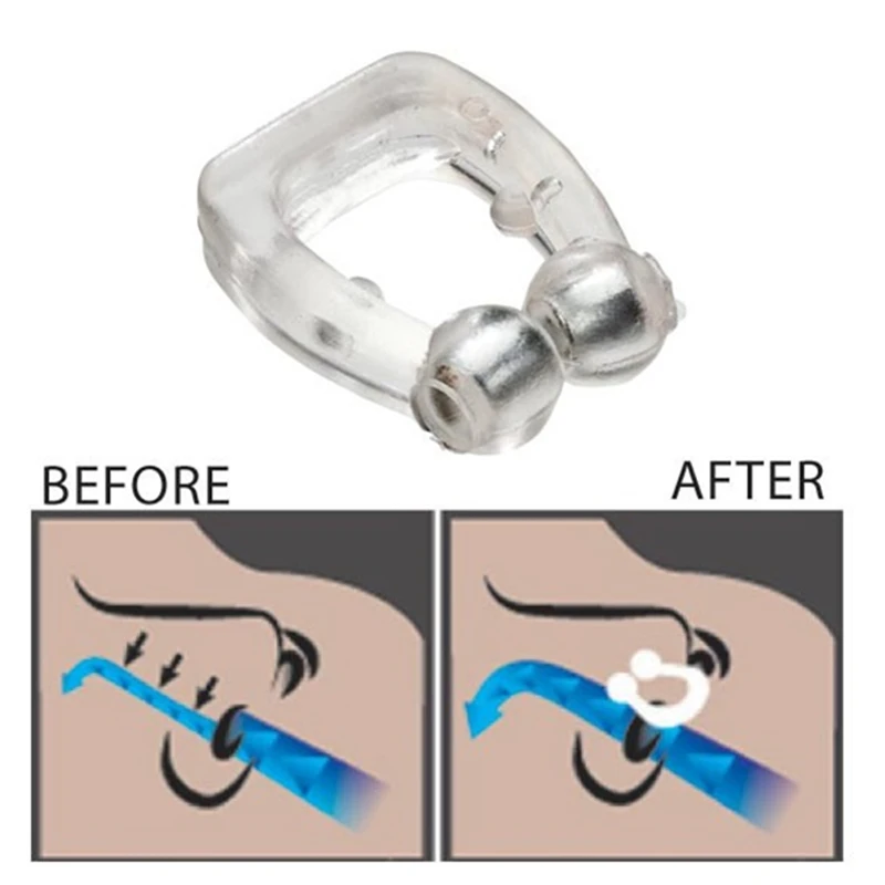 sleep apnea