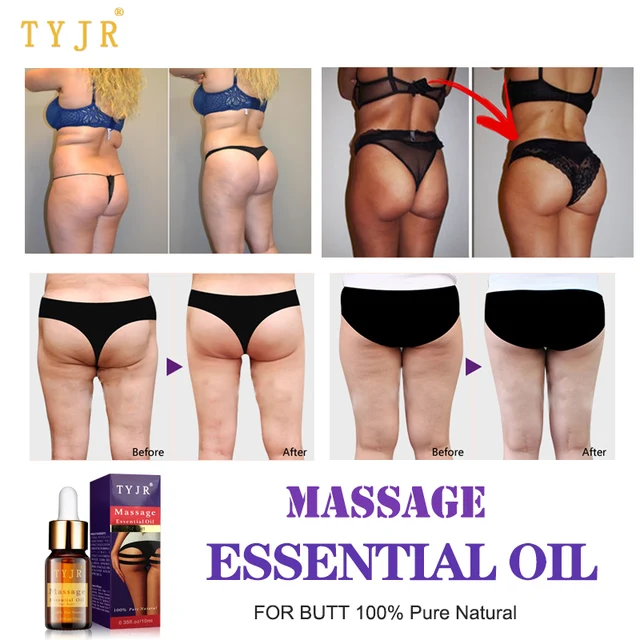 Fat Cellulite Butts Fat Cellulite Butts