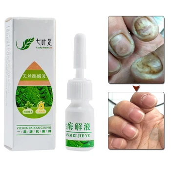 

Toe Nail Fungus Removal Oil Fungal Nail Treatment Feet Care Essence Nail Foot Whitening Anti Infection Paronychia Onychomycosis