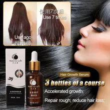30 мл шампунь ускоренный рост волос сыворотка для выпадения волос лечение строительные волокна выращивание-более быстрый уход за здоровьем красота масла для роста волос