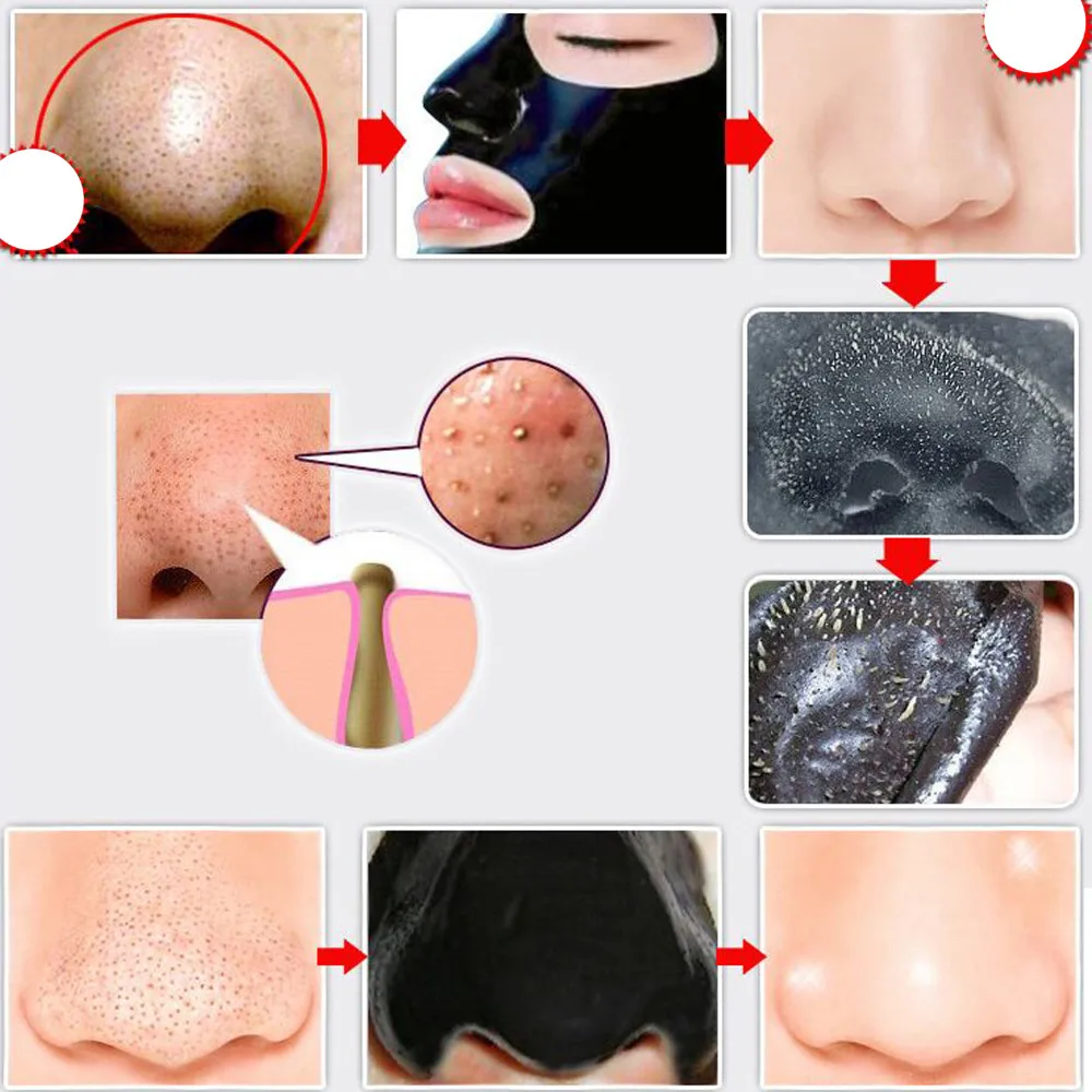 Removedor de Cravo Limpador de Cabeça Lote Pilaten Face Care Nariz Facial Máscara Minerais Poros Preta ex Poro Tira 100 Pçs - 5 facial removedor de cravo máscara minerais poros
