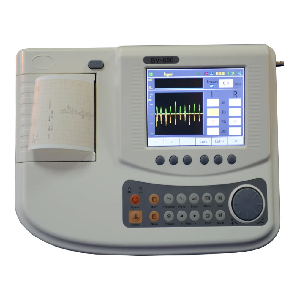 Аби допплер сосудов прокладка допплер системы 5,7 ''цветной ЖК-bidirection PPG зонд термопринтер и аккумуляторная батарея TBI BV650