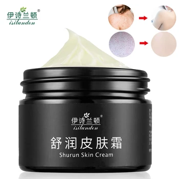 

ISILANDON Chinese Medicine Body Cream Remove Chicken Skin Whitening Moisturizing Skin Care Body Care Free Shipping