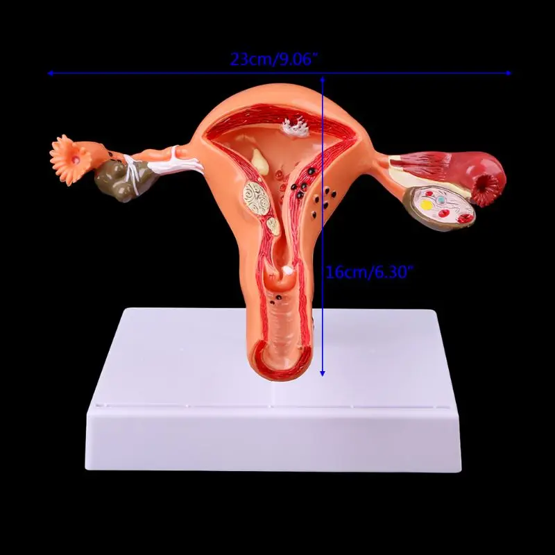 Медицинский реквизит модель почтовая патологическая матка яичник анатомическая модель Анатомия поперечное сечение исследование инструмент